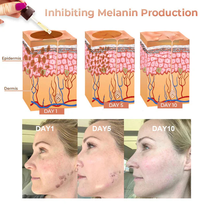 NESLEMY™ Melanin Correcting Facial Serum