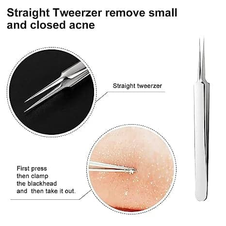 Professional Facial Blackhead Remover Tweezers (3Pcs+Box)